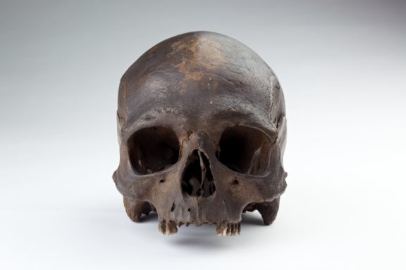 Image of a human skull